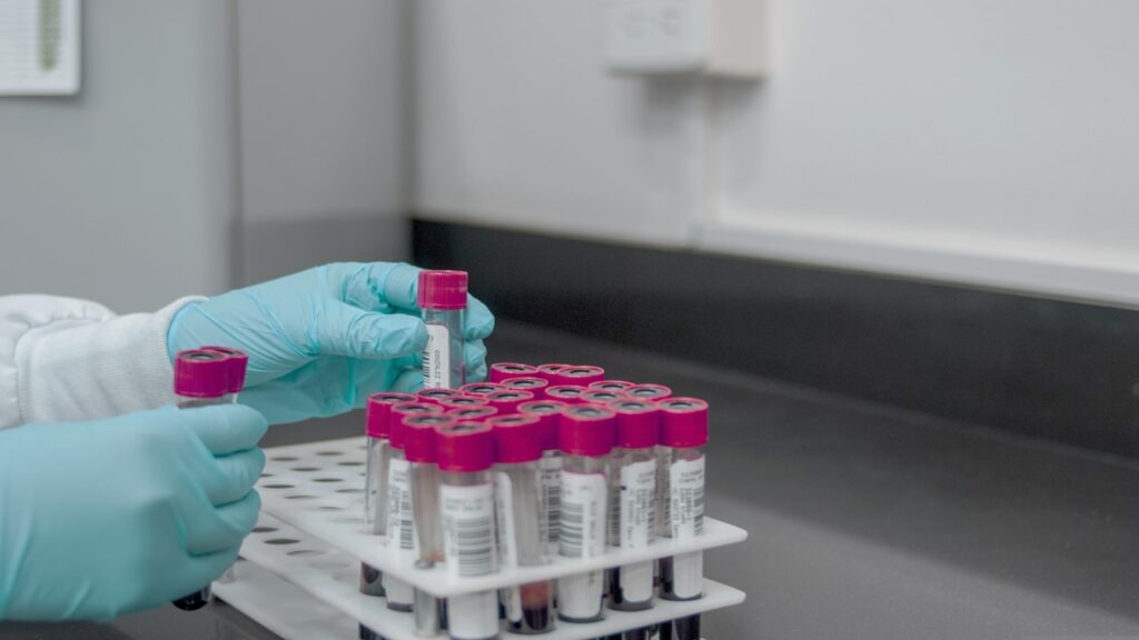 late prenatal appointment, impact on routine prenatal tests and screenings, pregnancy doctor visit, what happens if you go late for prenatal appointment