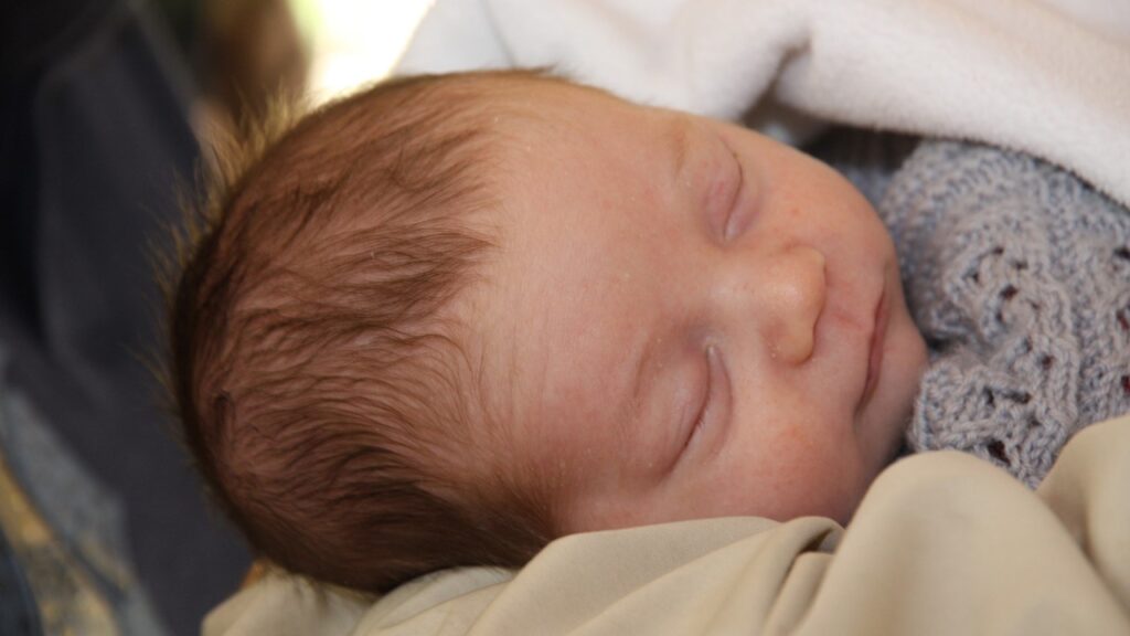 when to worry about newborn jaundice, newborn jaundice 2026
