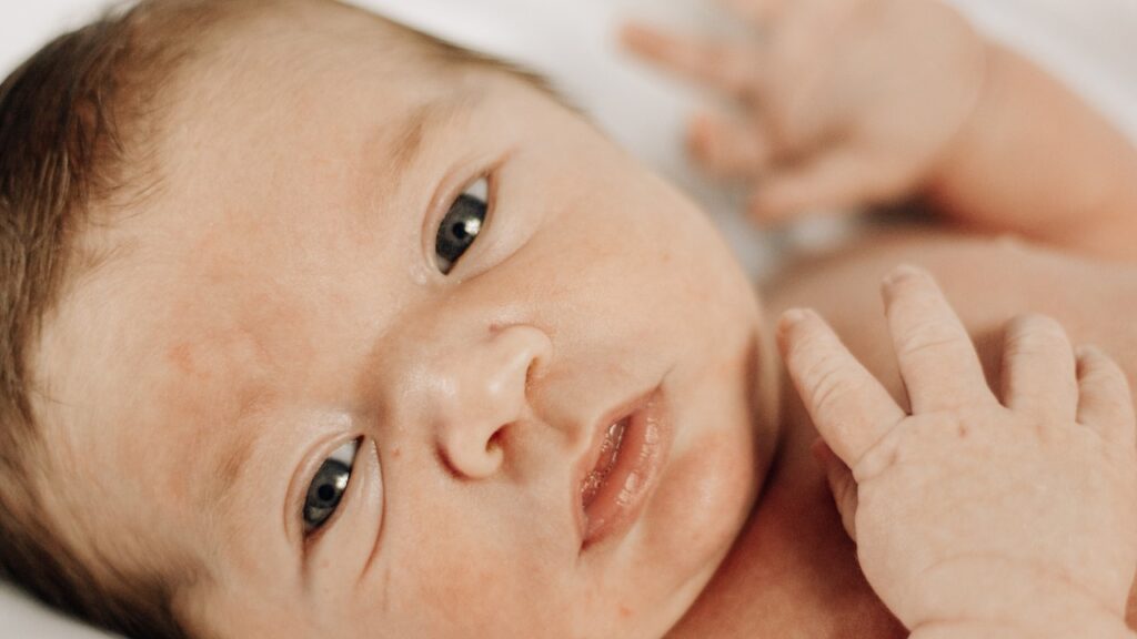 jaundice in premature vs term babies, newborn jaundice care plan