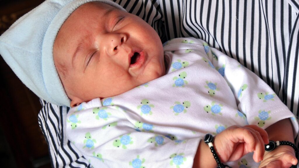 newborn jaundice phototherapy at home, normal bilirubin levels for newborns by age