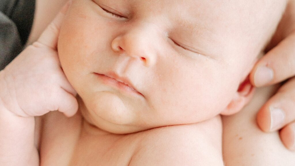 how to prevent severe hyperbilirubinemia, newborn jaundice AAP guidelines